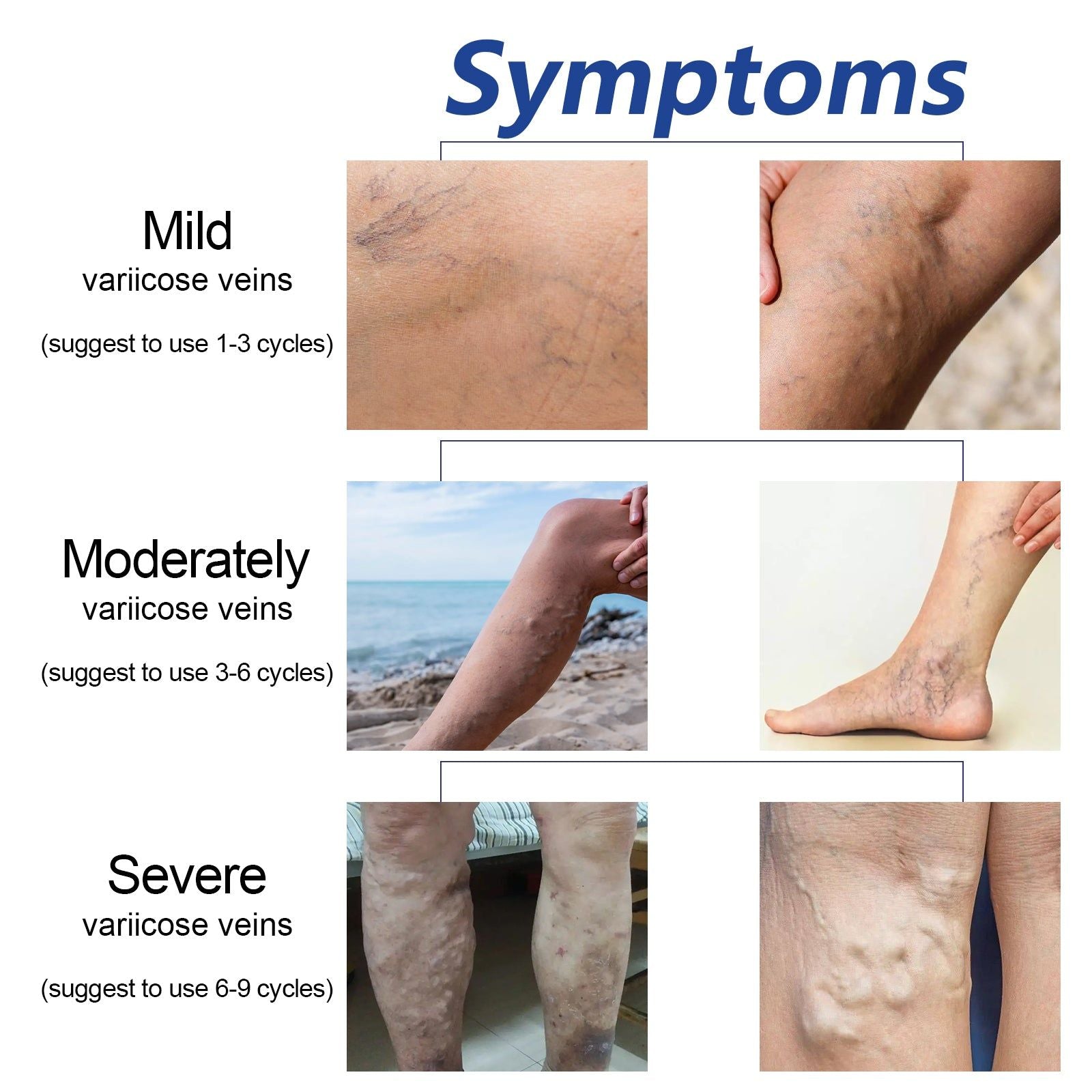 Hot Leg Sleeves for Lymphatic Relief, Blood Circulation, Venous Care, Warm Leg Cover ,1 pair