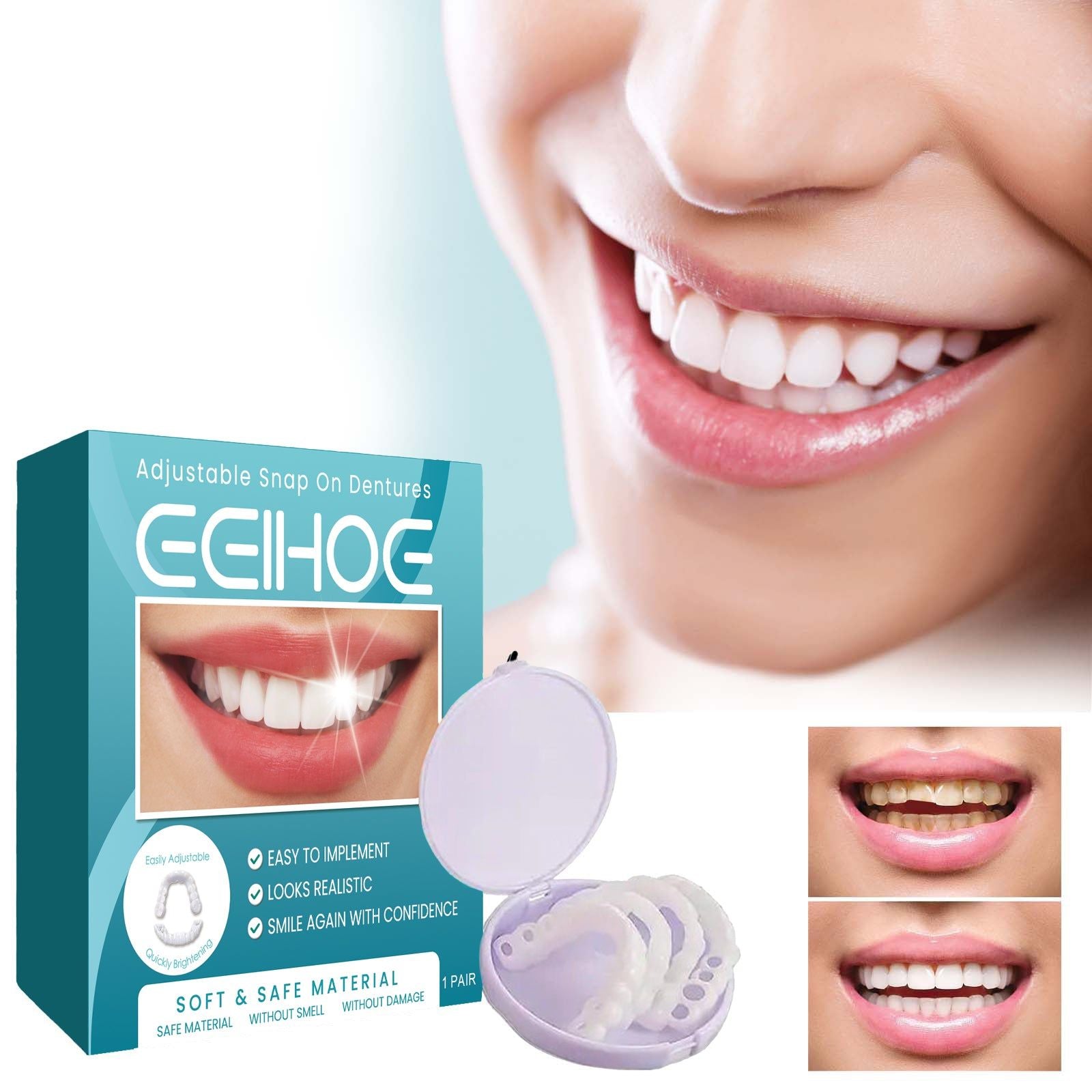 Adjustable Orthodontic Denture Kit, Easy, Non-Invasive, Affordable Smile Repair ,1pairs