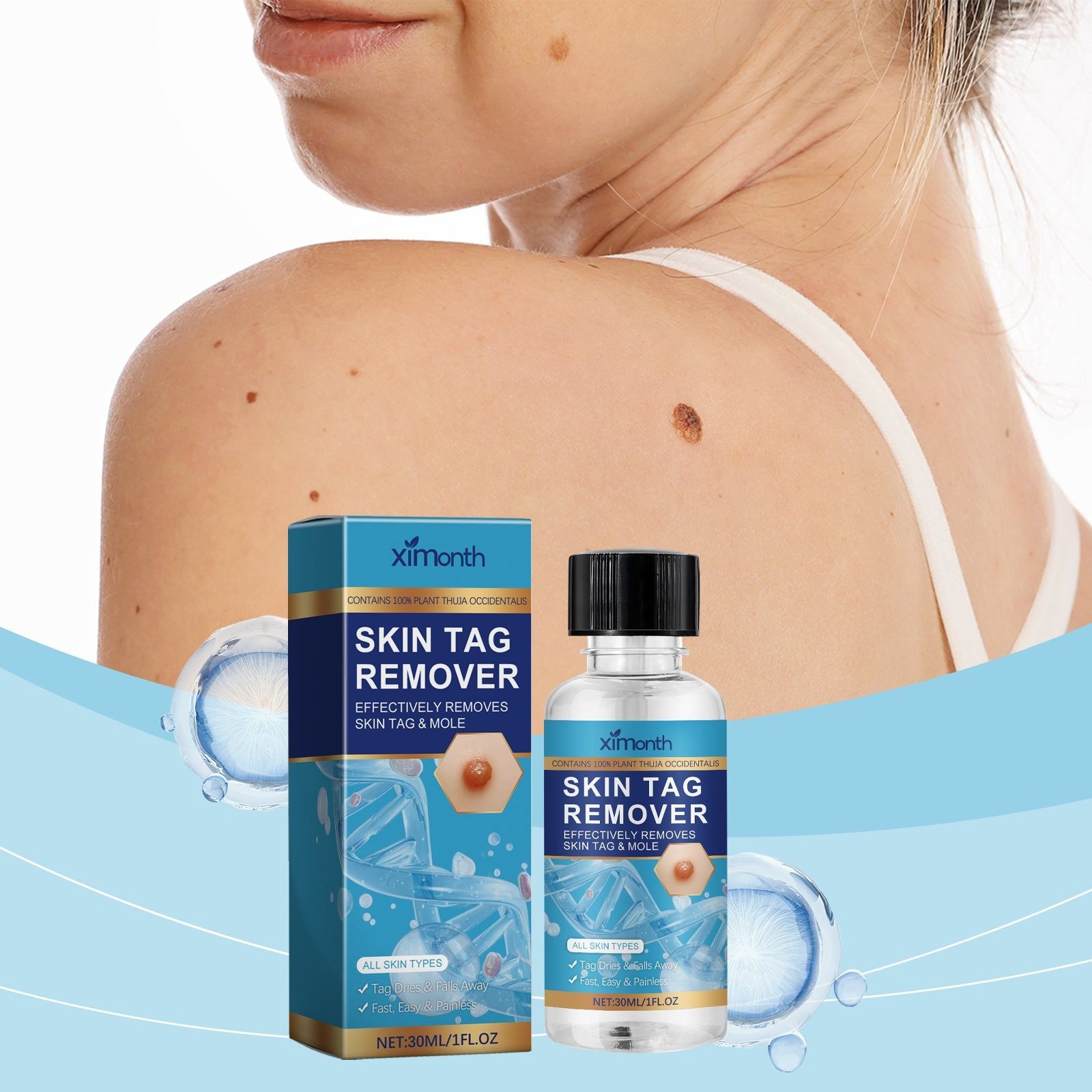 Keyu Liquid for Skin Repair, Moisturizing, Moles & Skin Care, Fast Absorption ,30ml