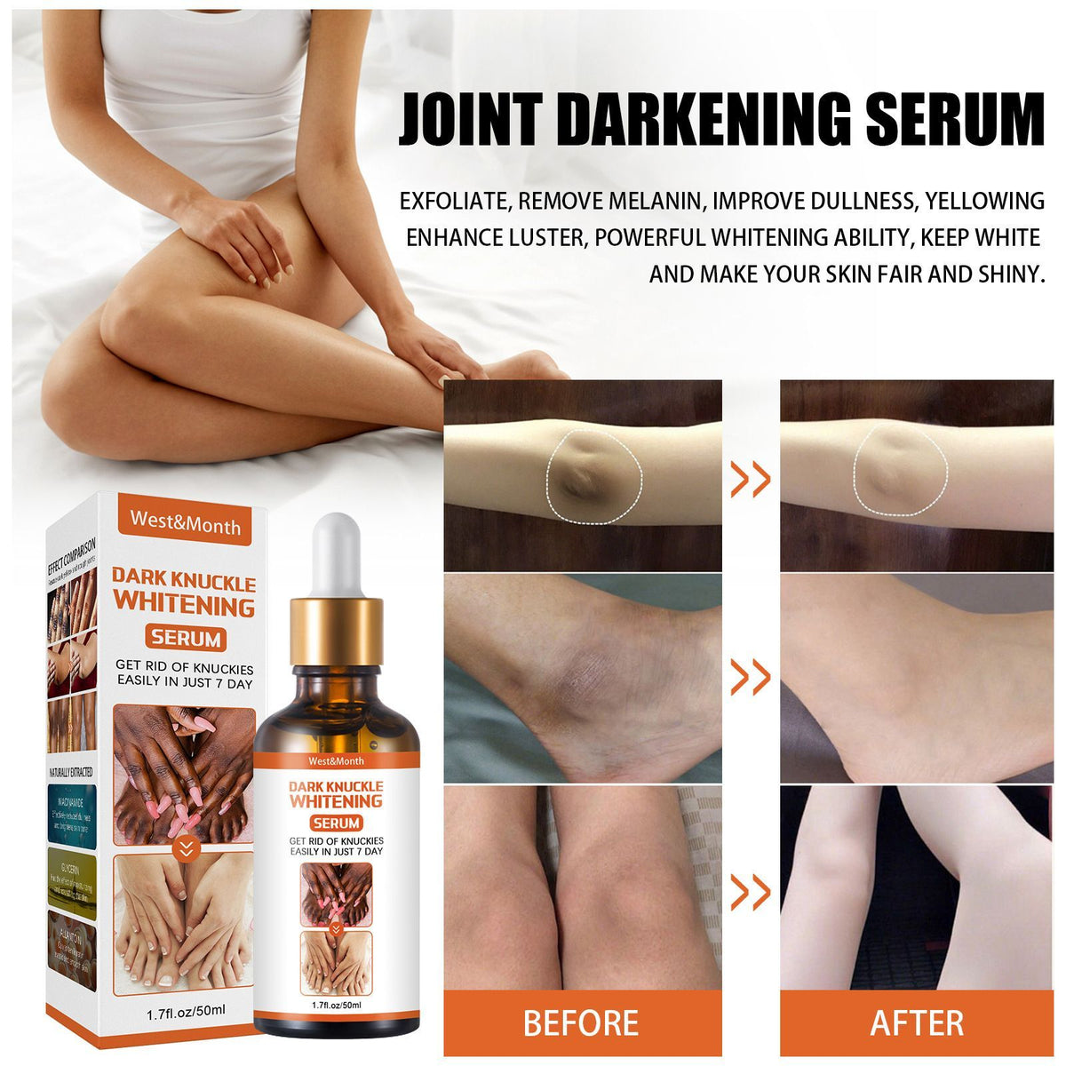 Dark Knuckle Whitening Serum Hand Elbow Knee Brightening Serum Skin Moisturizer