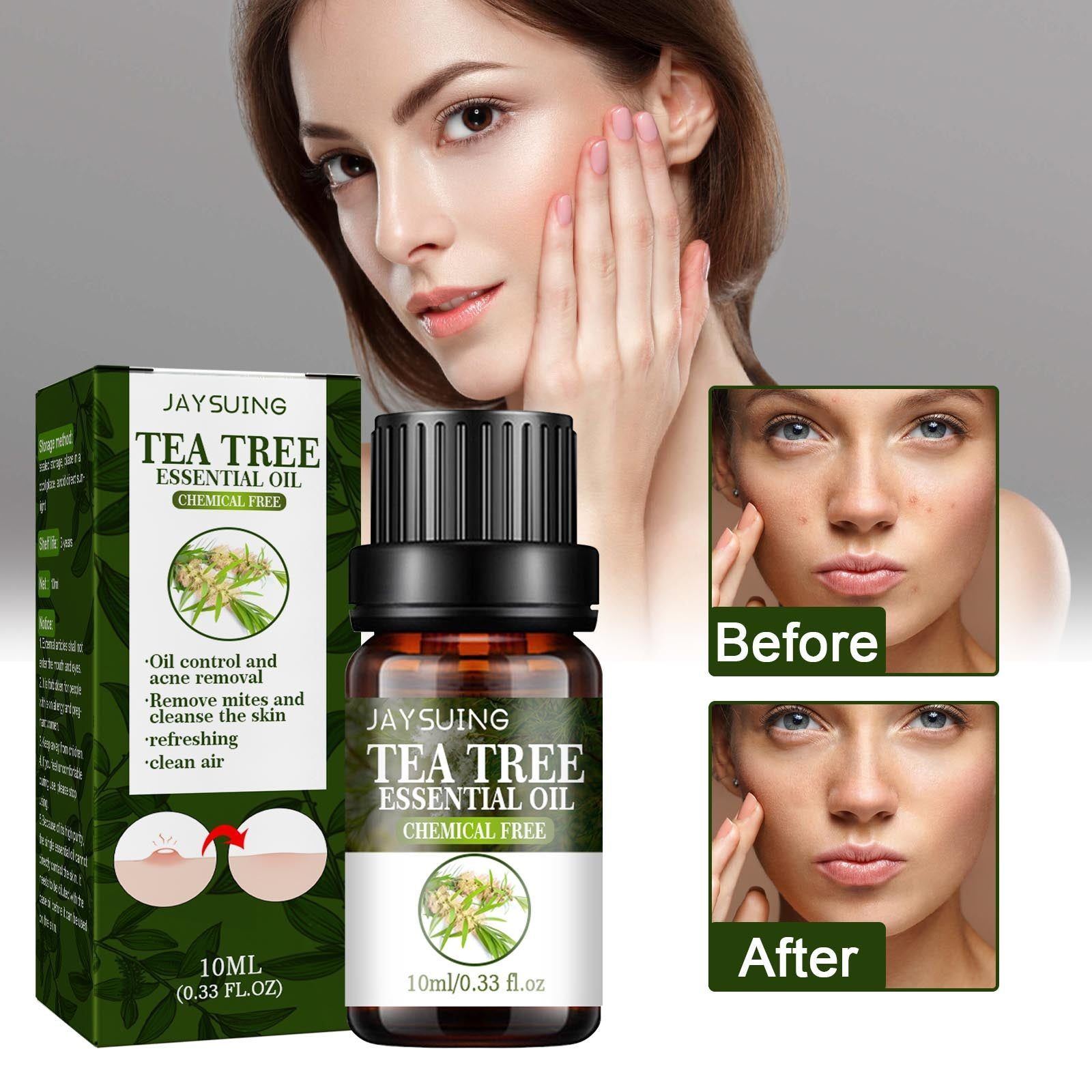 Tea Tree Oil for Acne, Oil Control, Mite Removal, Skin Purifying, Refreshing ,10ml/box