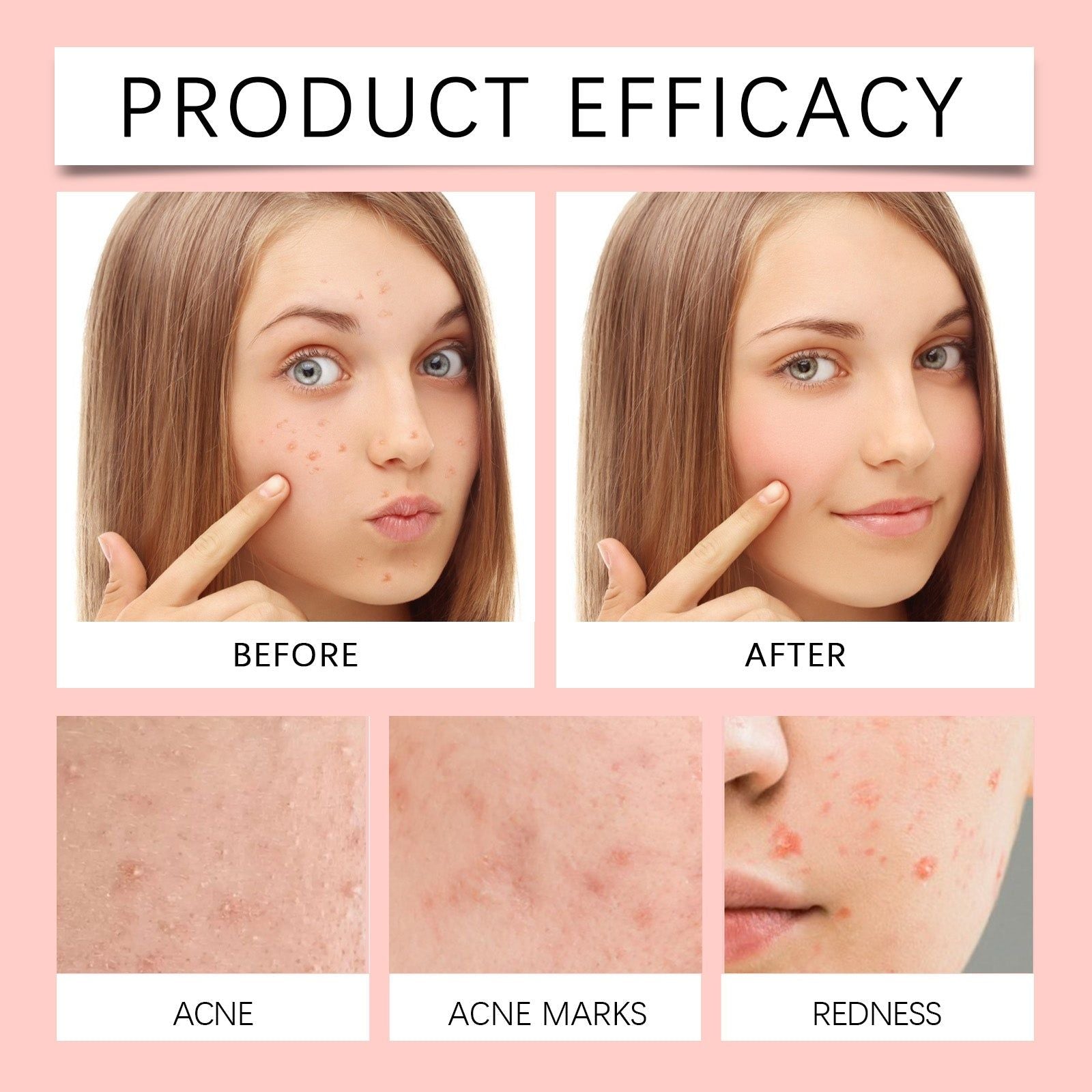 Clear Acne Fast with Acne Patch, Skin Care, Scar Repair, Invisible ,36pcs