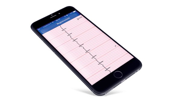 MEDEL 95129 CARDIO U/P BP MONITOR