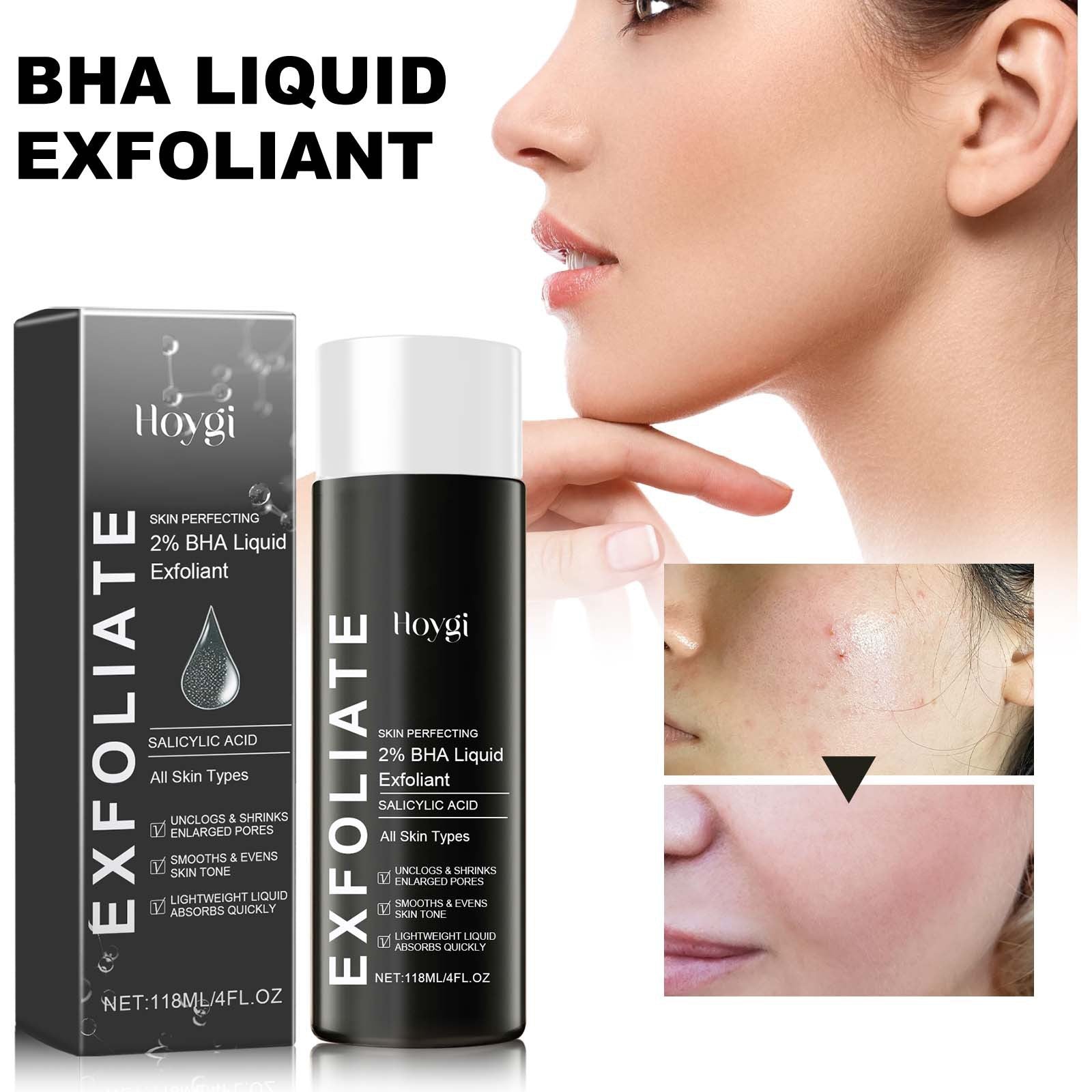 Salicylic Acid Acne Serum, BHA Liquid Exfoliant, Pore Tightening, Clear Skin, Moisturizing ,118ml