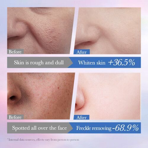 Dark Spot Correcting Niacinamide Spot-Removing Essence - 001- SD37558