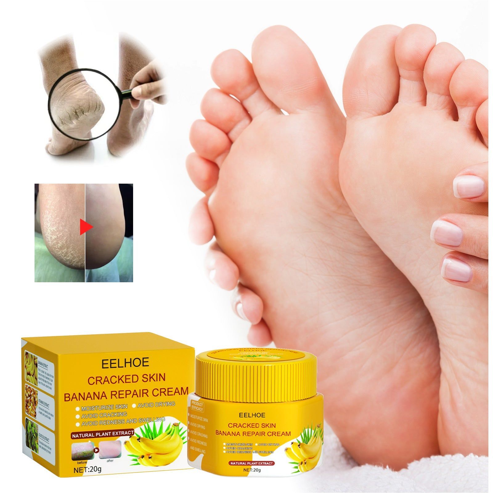 Banana Repair Cream for Dry Rough Hands Feet, Hydrating, Soothing, Anti-Cracking ,20g