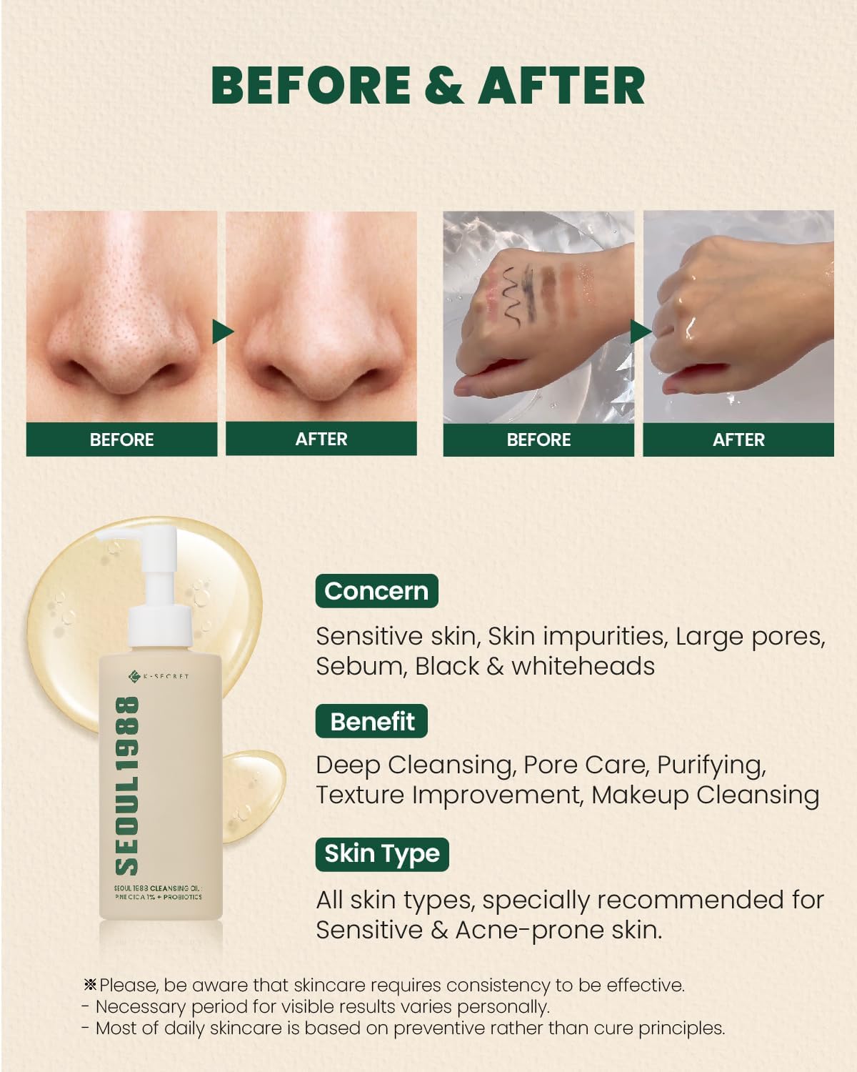 K-SECRET SEOUL 1988 Cleansing Oil : Pine Cica 1% + Probiotics 200ml