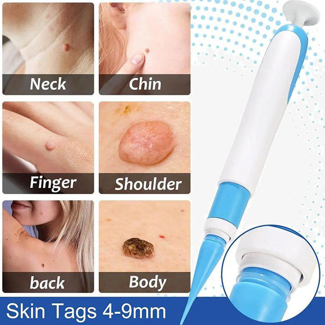Auto Skin Tags Removal Tool Device with Cleansing Wipes - Safe, Painless Skin Tag Remover Kit