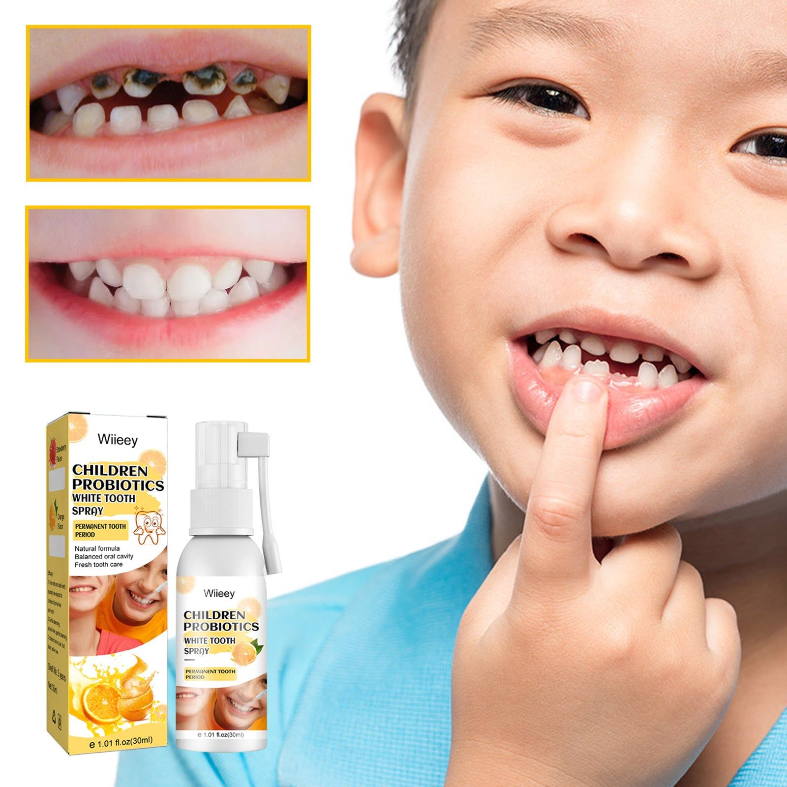 Children's Teeth Cleaning Spray, Fresh Breath, Probiotic Oral Care, Natural Whitening ,30ml