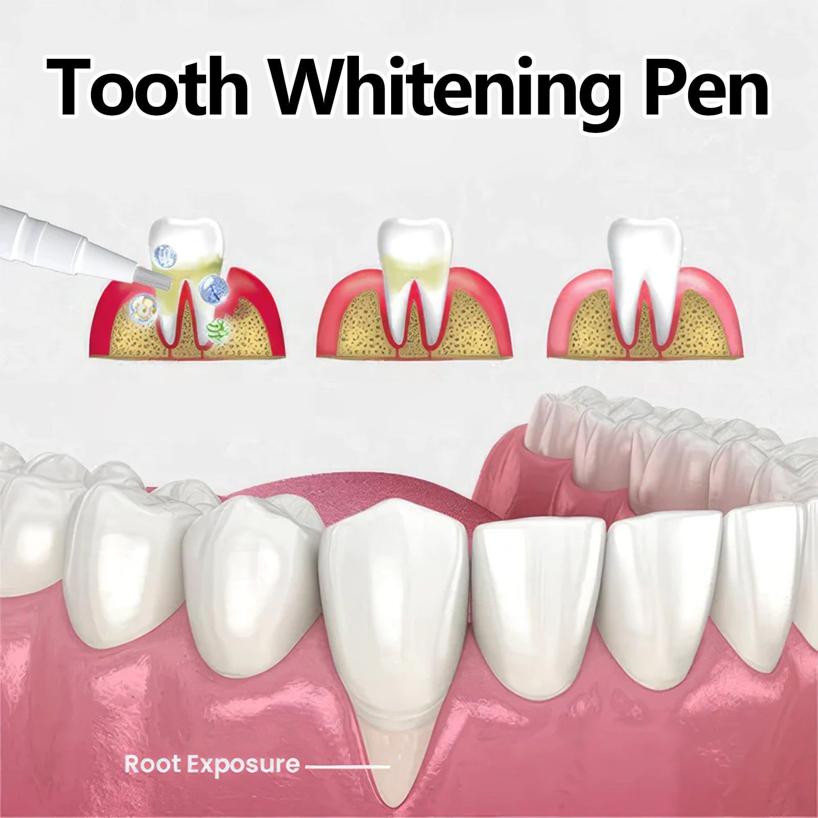 Brighten Your Smile with Teeth Whitening Care Pen, Easy Stain Removal, Long-lasting White Teeth ,2pcs