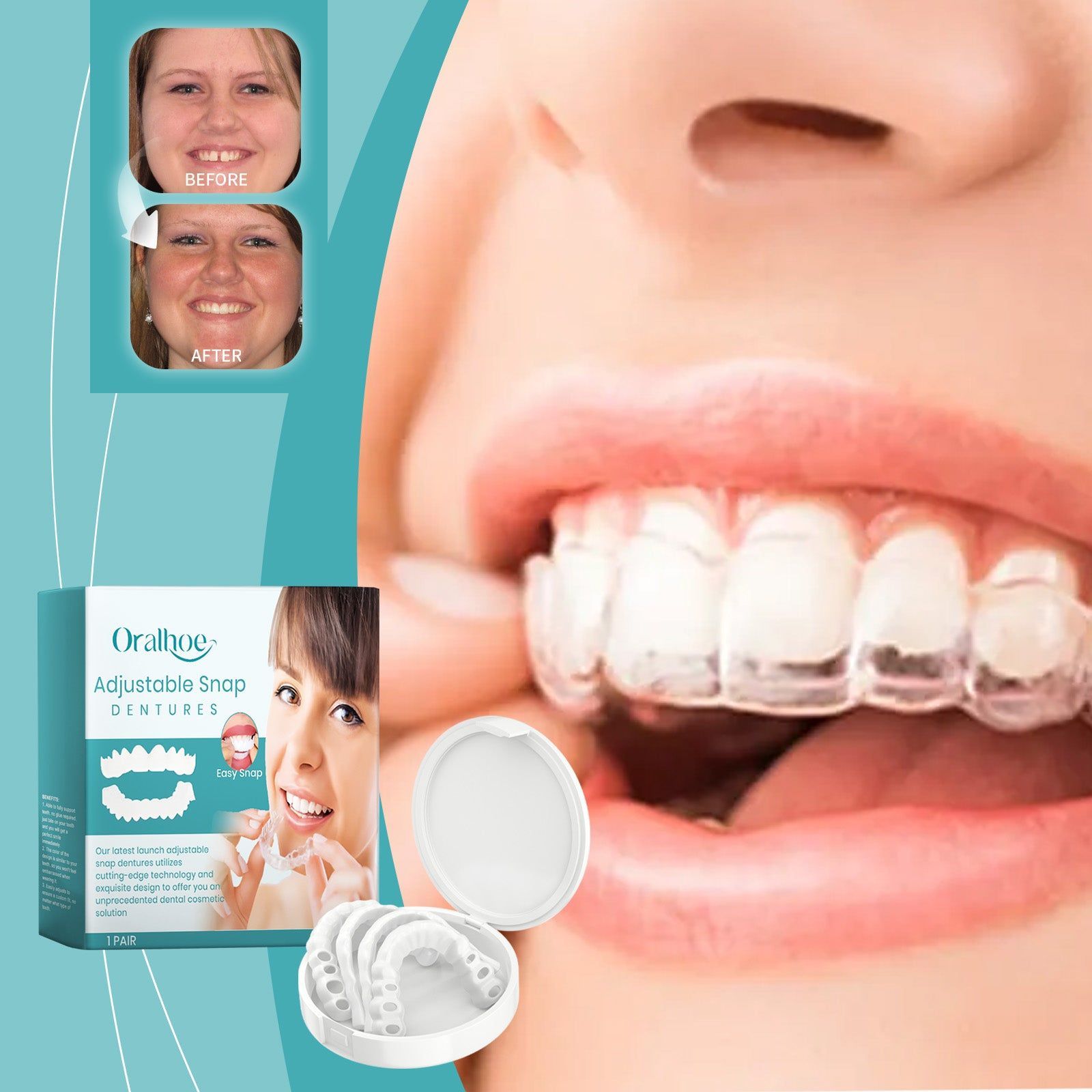 Adjustable Silicone Dentures for Comfortable Dental Care, Custom Fit, Easy to Use ,1pair
