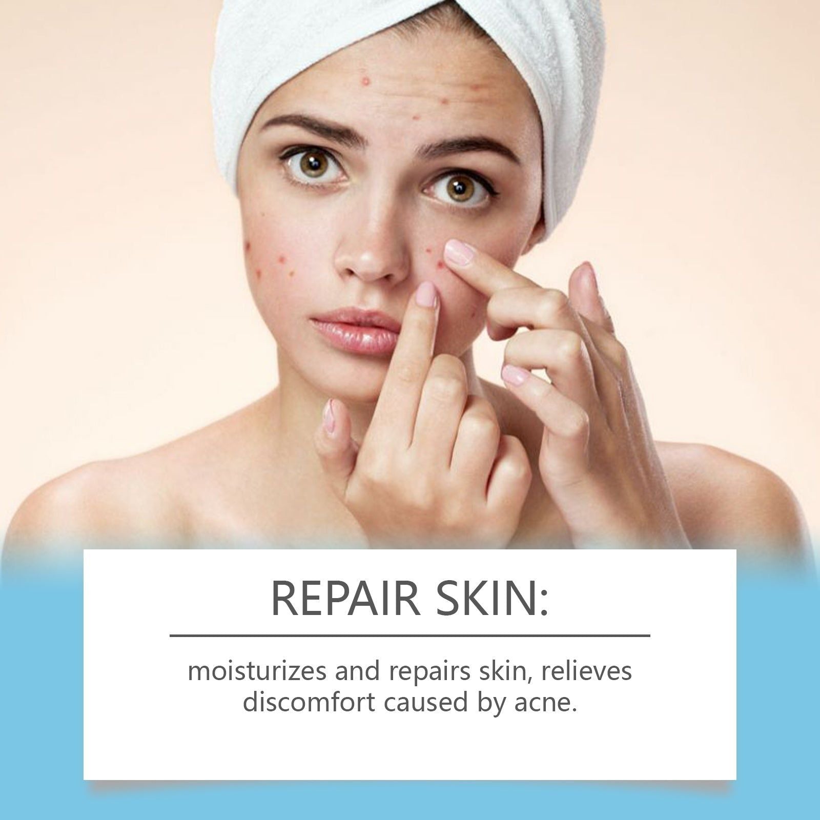Clear Acne Marks Fast, Acne Repair Cream for Flawless Skin, Pimple Scar Treatment ,20g