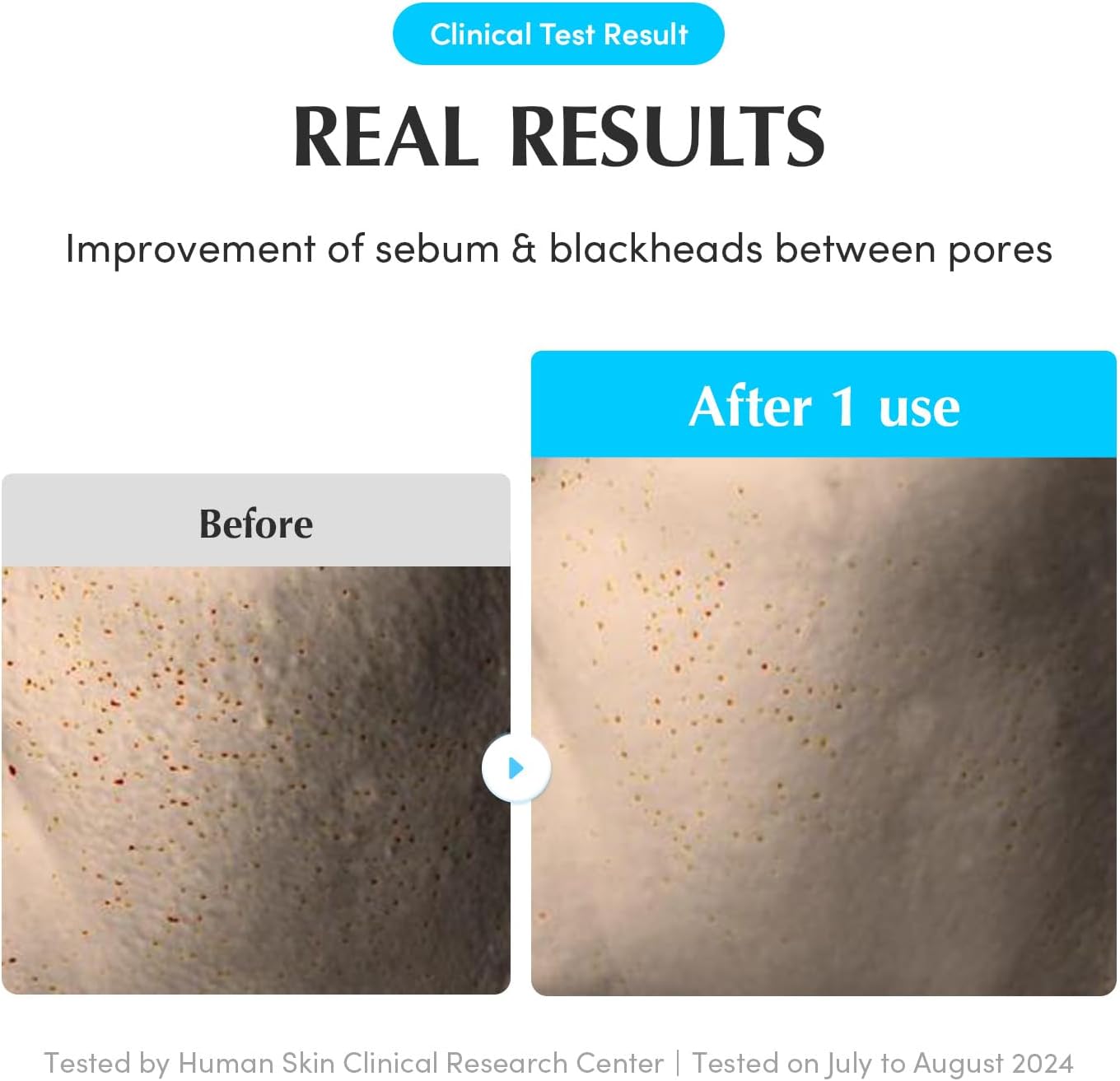 Eqqualberry Swimming Pool Toner Pads 220Ml | 70 Sheets