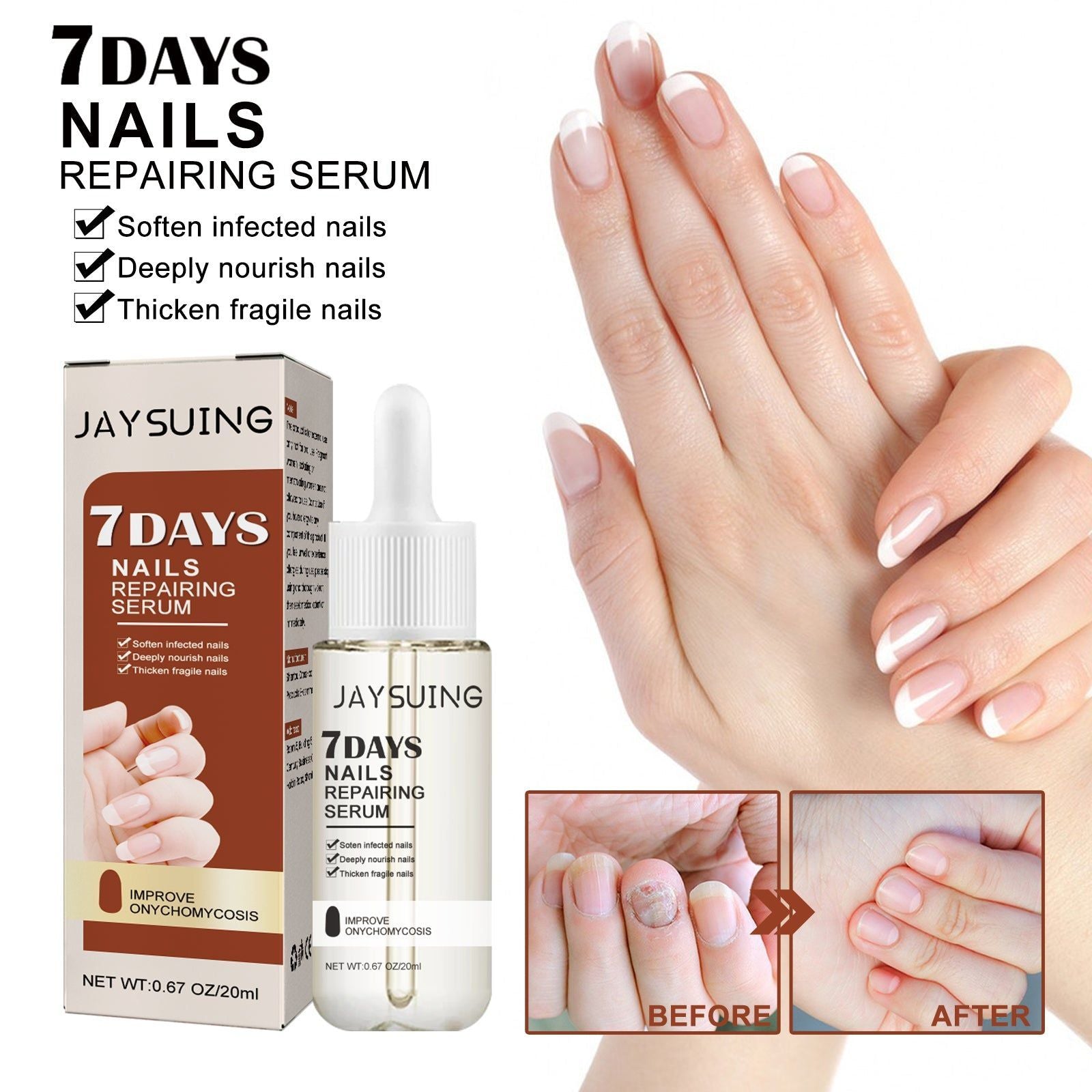 7 Day Nail Care Essence for Manicure, Stronger Nails, Fungal Treatment, Nourishing Serum ,20ml