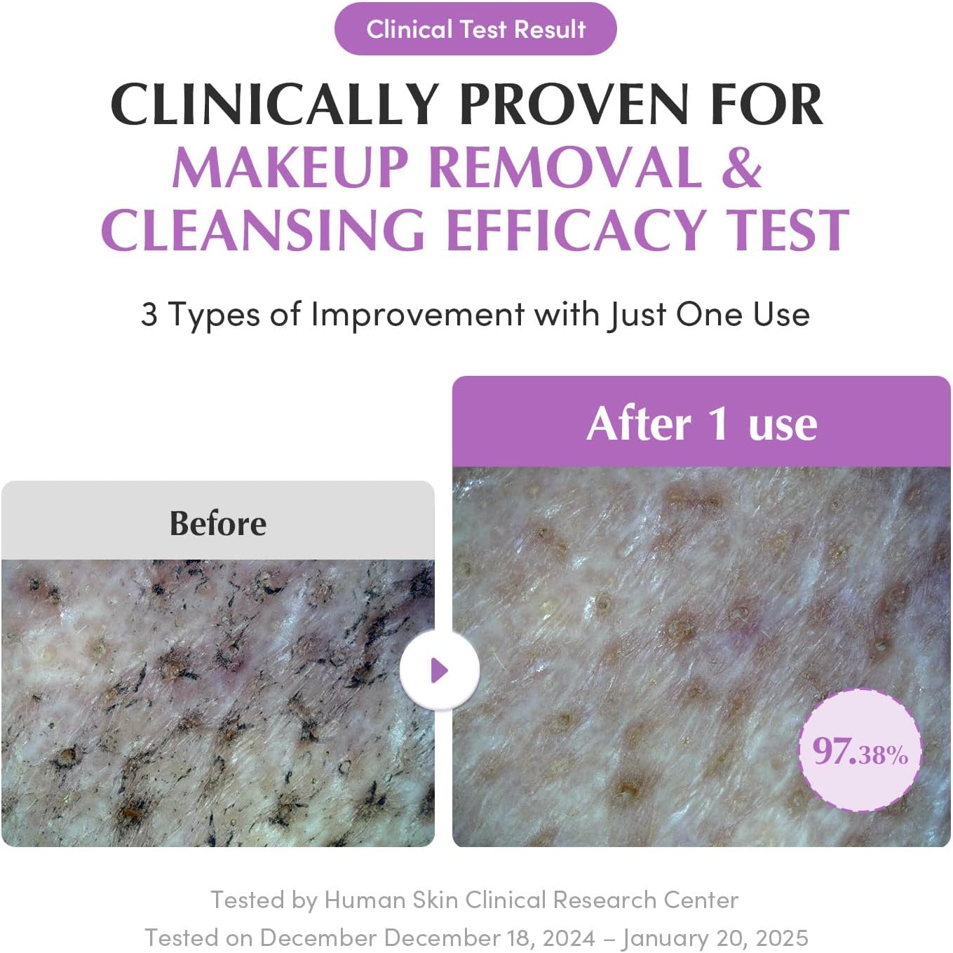 Eqqualberry Purple Rice Pore Smoothing Cleansing Oil 200Ml