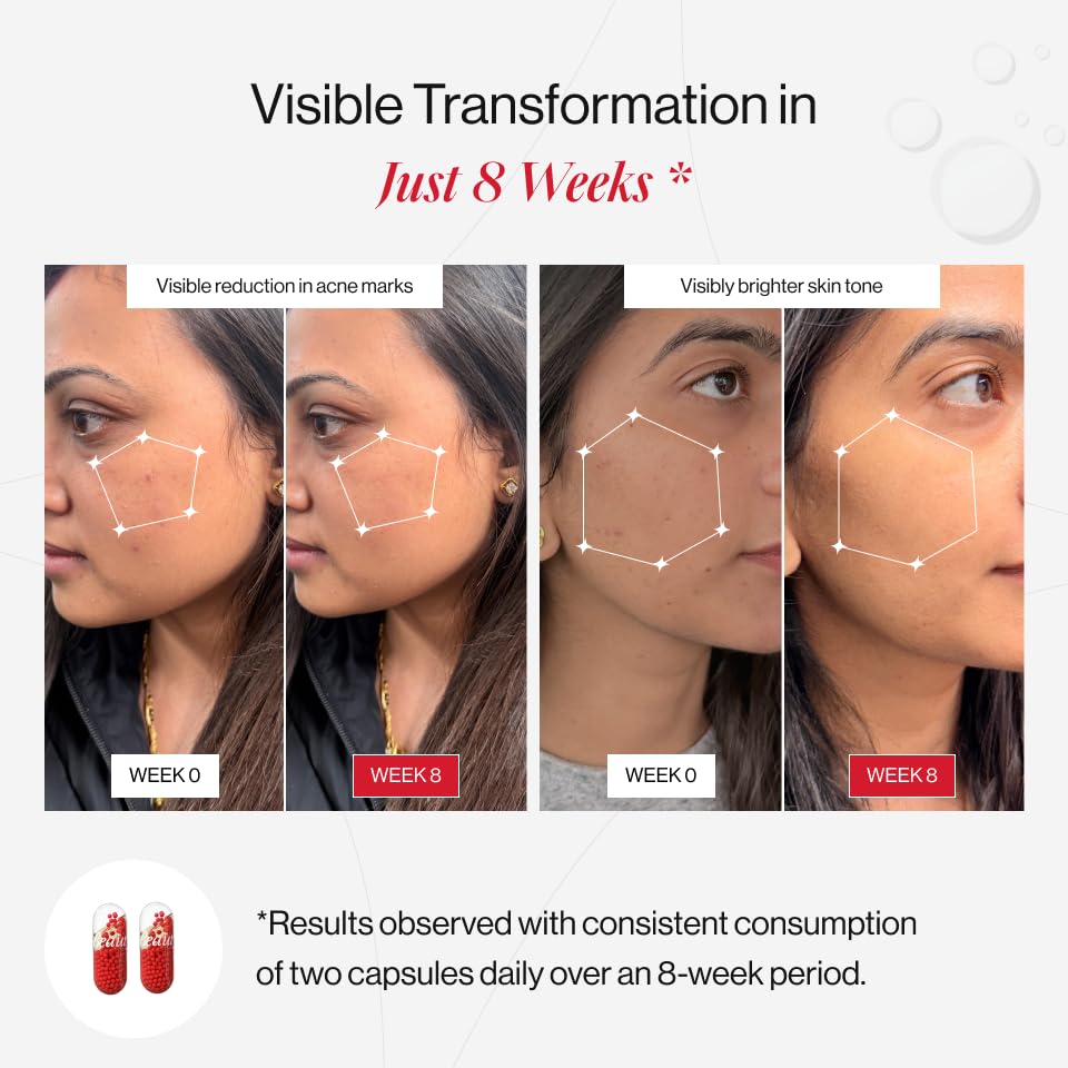 Beautywise Dual Action Skin Brilliance Glutathione Capsules (30 capsules)