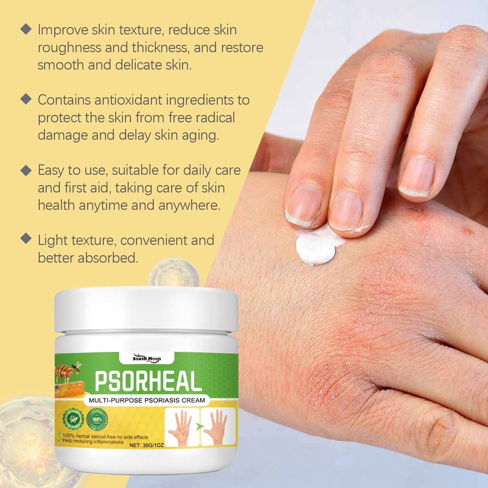 Skin Care Cream, Deep Moisturizer for Body, Hands, Feet, Psoriasis Relief ,30g