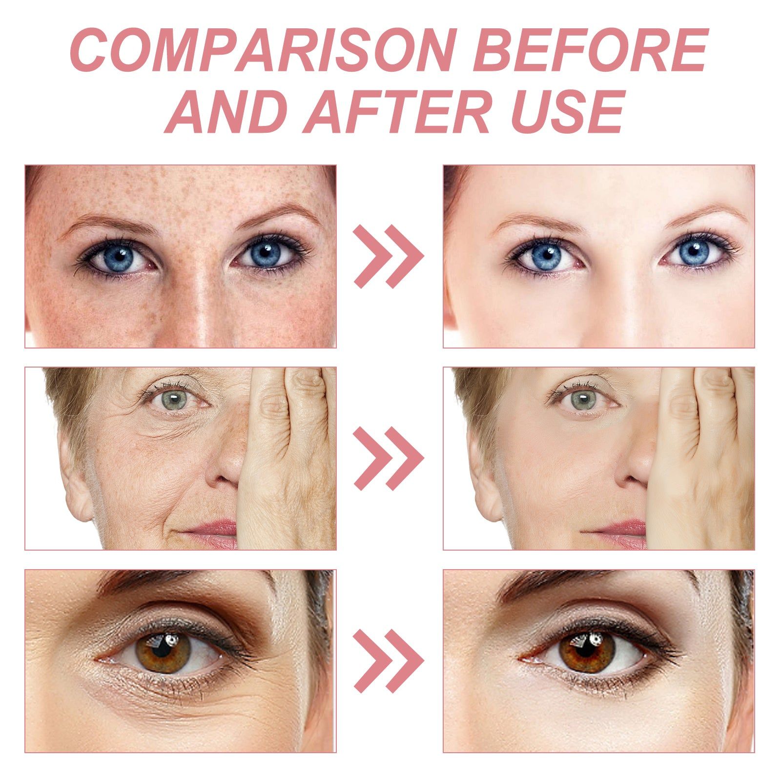 5 in 1 Firming Cream, Nourishing, Hydrating, Reduces Wrinkles, Brightens Sensitive Skin ,50g
