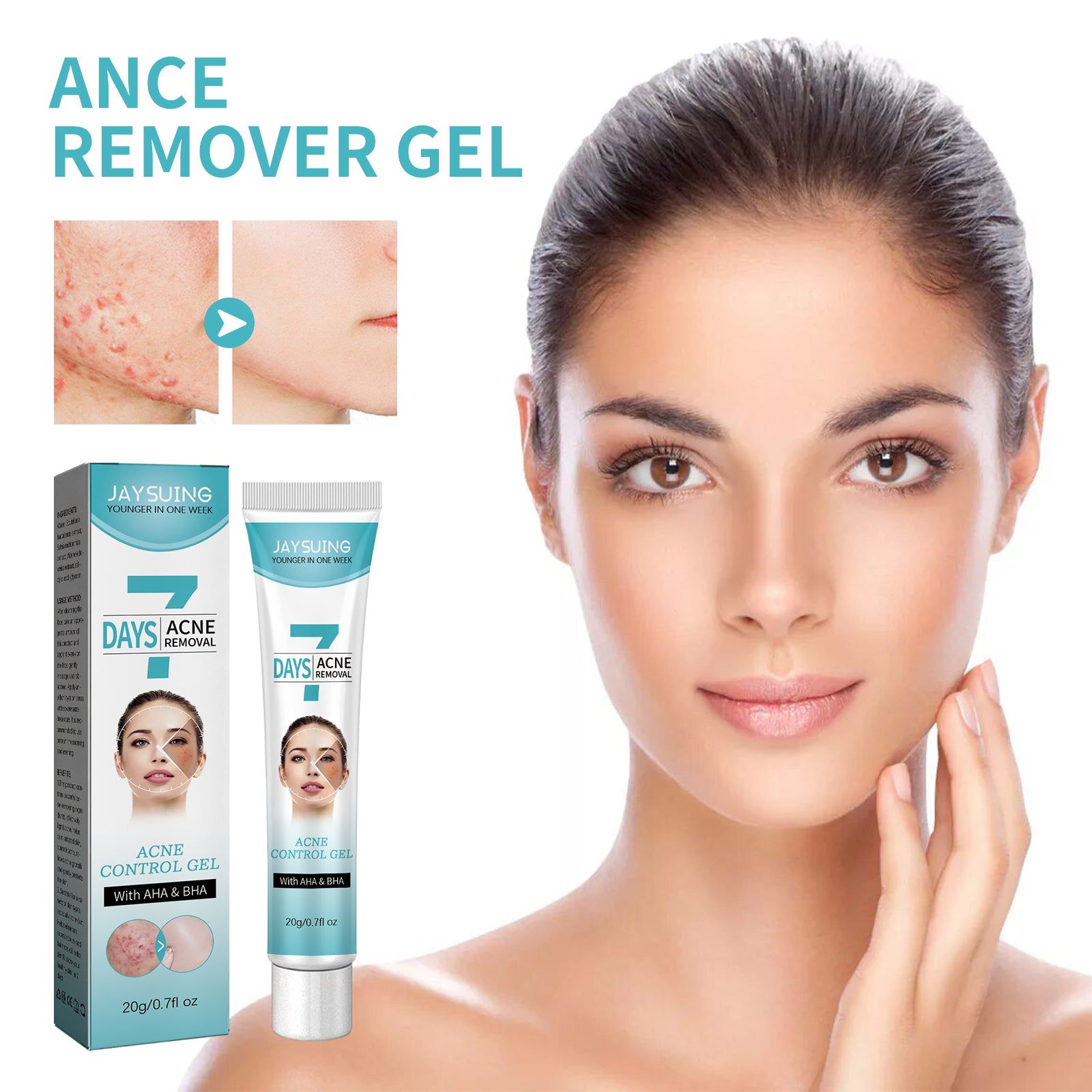 Clear Acne Marks Fast, Hydrating Repair Gel for Bright, Smooth Skin ,20g