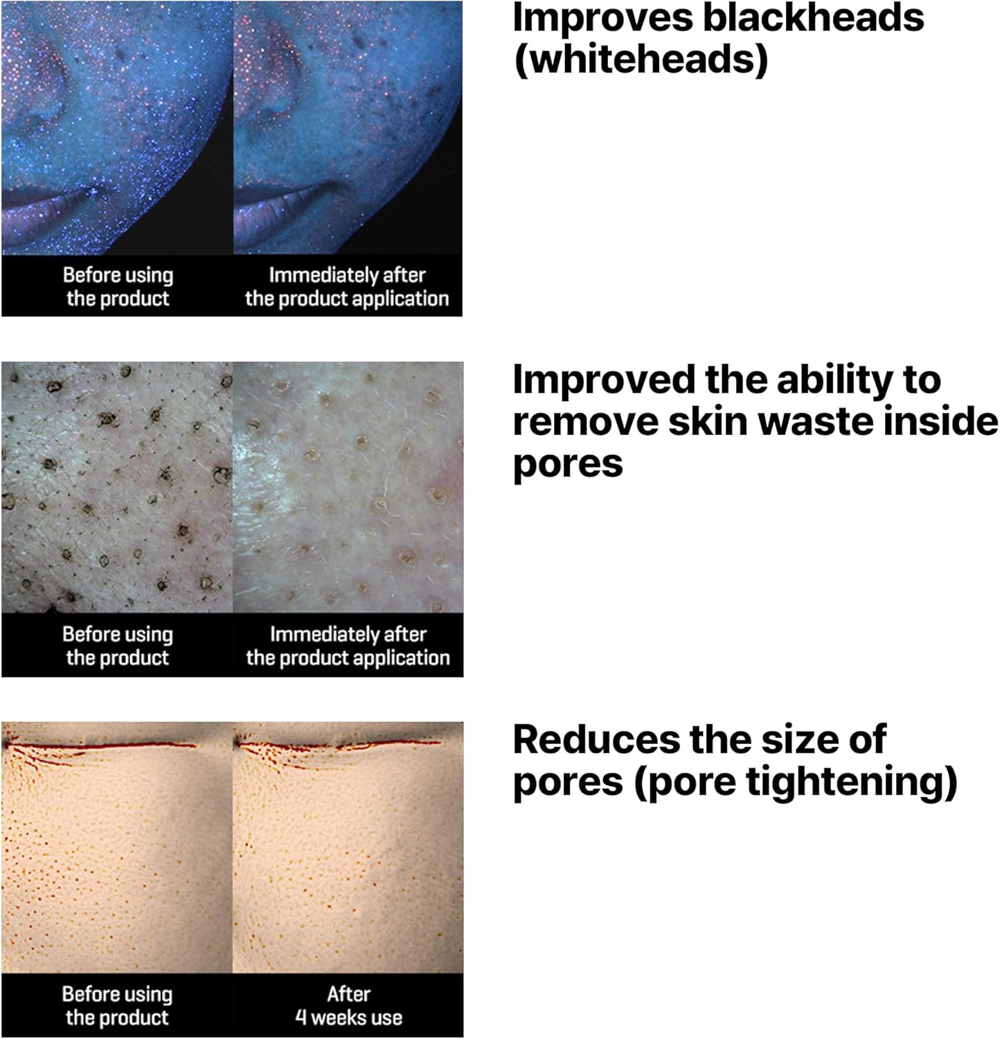 زيت منظف البشرة Some By Mi Lacto Soy Sebum Blackhead Cleanser Oil 200 مل