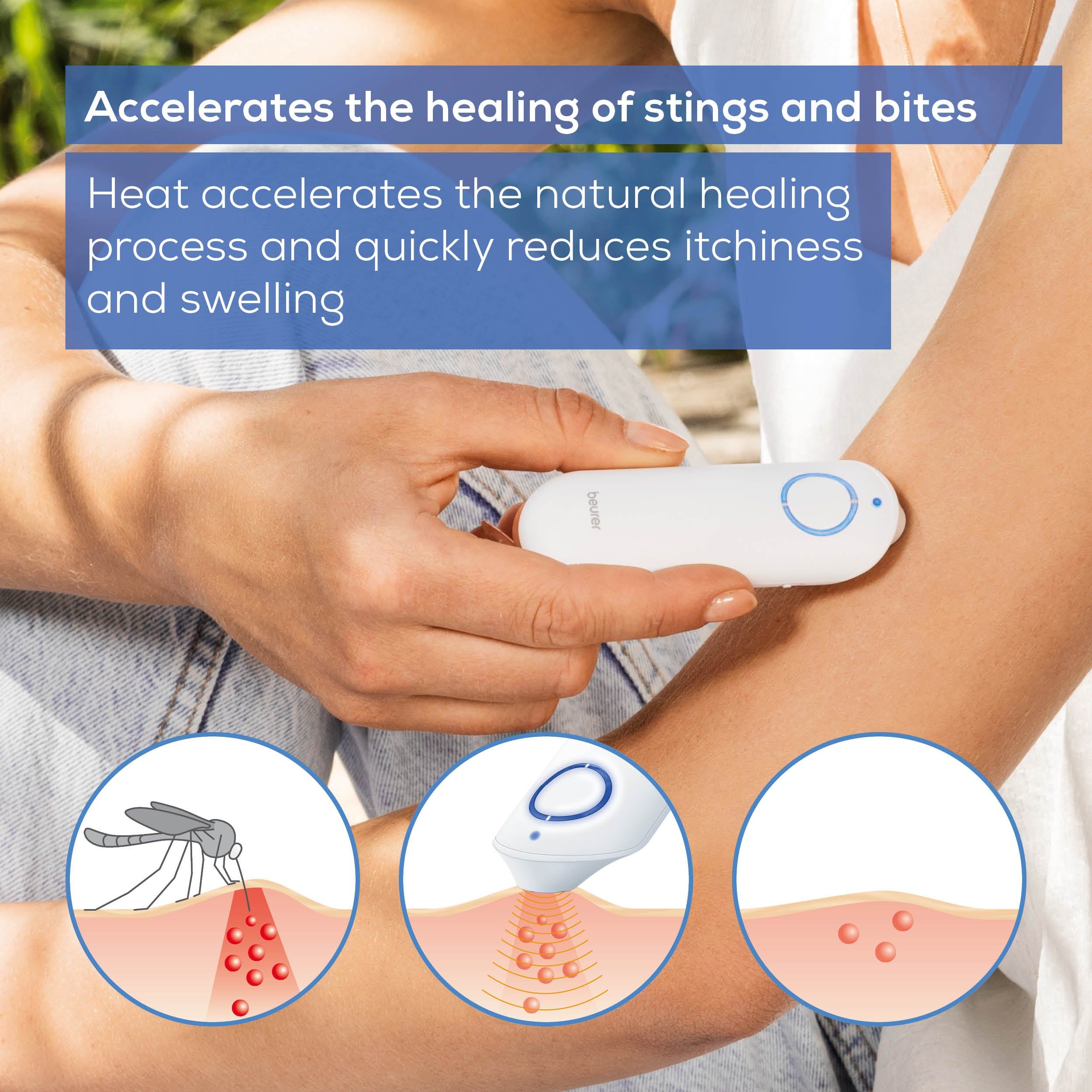 Beurer Insect bite healer BR 60