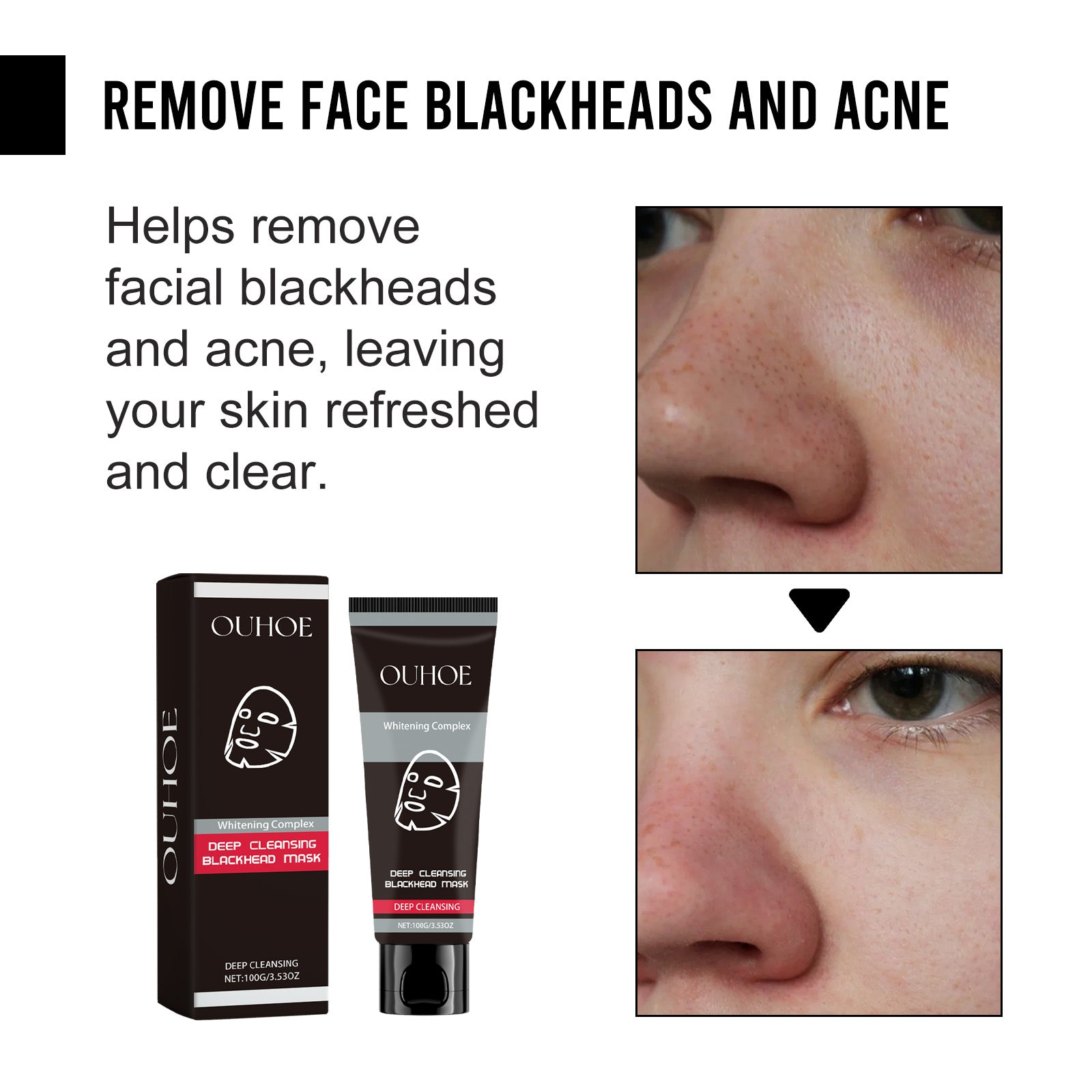 Deep Cleansing Facial Mask, Charcoal & Bamboo Extract, Pore Purifying, Acne & Blackhead Removal ,100g