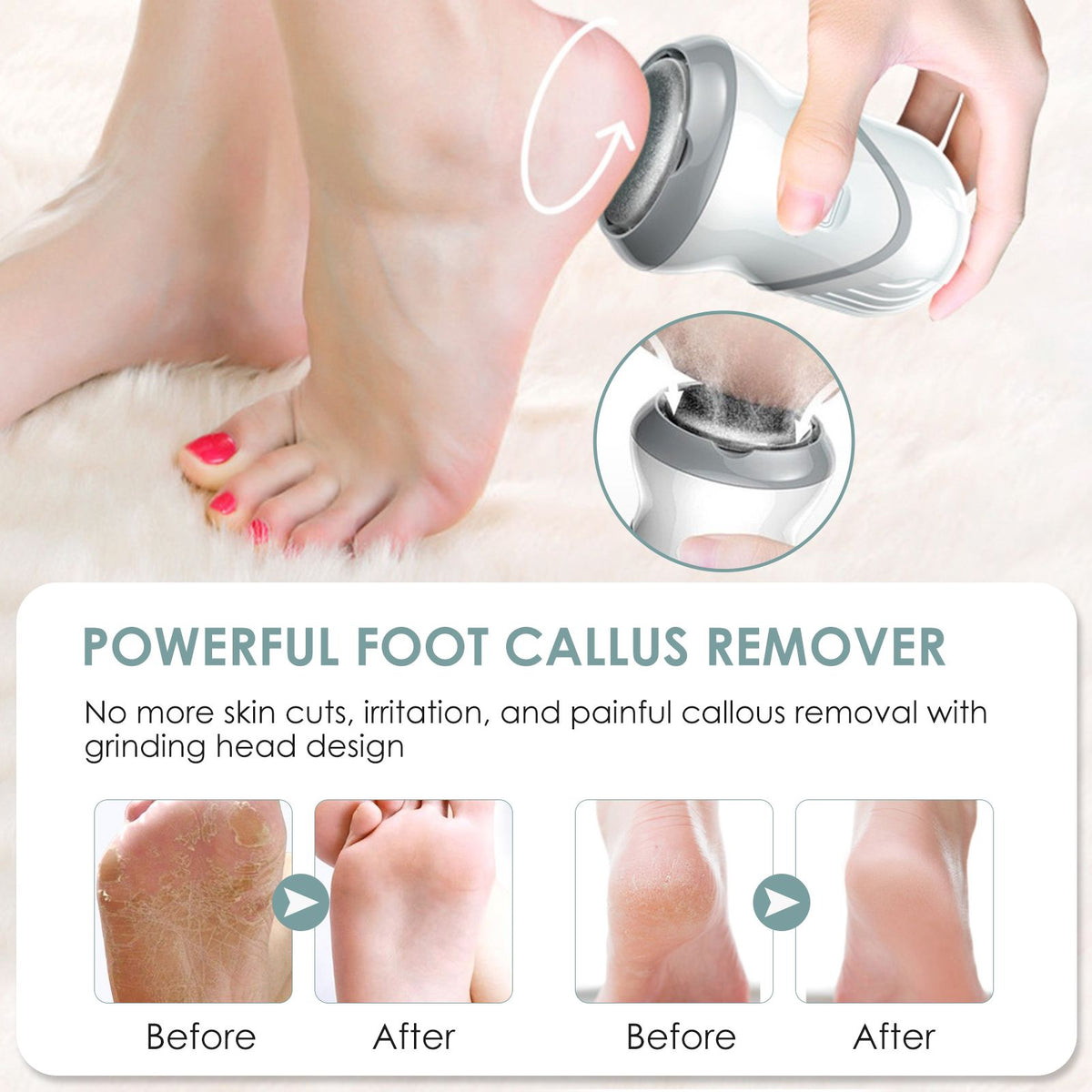 Electric Foot Callus Remover Foot Grinder Pedicure Device With 3 Grinding Heads
