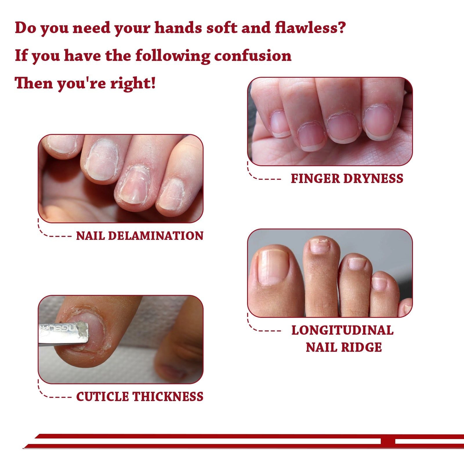 Cuticle Oil for Nail Repair, Moisturize, Strengthen, Exfoliate, Nourish ,30ml